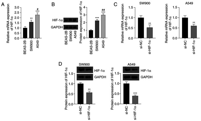 (A) Expression of HIF-1α mRNA in SW-900 and A549 NSCLC cell lines and normal BEAS-2B cells determined using reverse transcription-quantitative polymerase chain reaction. (B) Results of the western blot analysis of HIF-1α protein. (C) mRNA and (D) protein expression of HIF-1α in NSCLC cells transfected with si-HIF-1α.