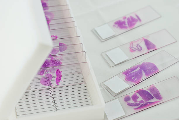 Immunohistochemistry Controls