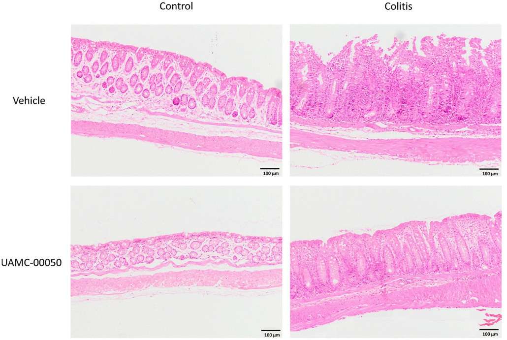 H E stained colon sections showing effects of UAVC-00050 treatment at 10x magnification across control and colitis groups with vehicle and treatment.