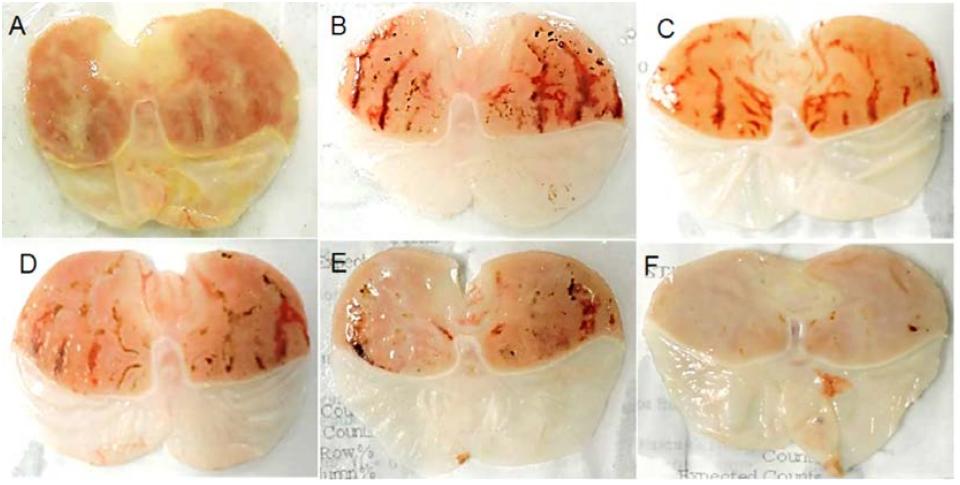 Fig. 1 Gastric ulcer area of ethanol-induced ulceration in rats. (A) Vehicle control; (B) ulcer control; (C) ExPhy (100 mg/kg); (D) ExPhy (200 mg/kg); (E) ExPhy (400 mg/kg); (F) omeprazole (40 mg/kg).