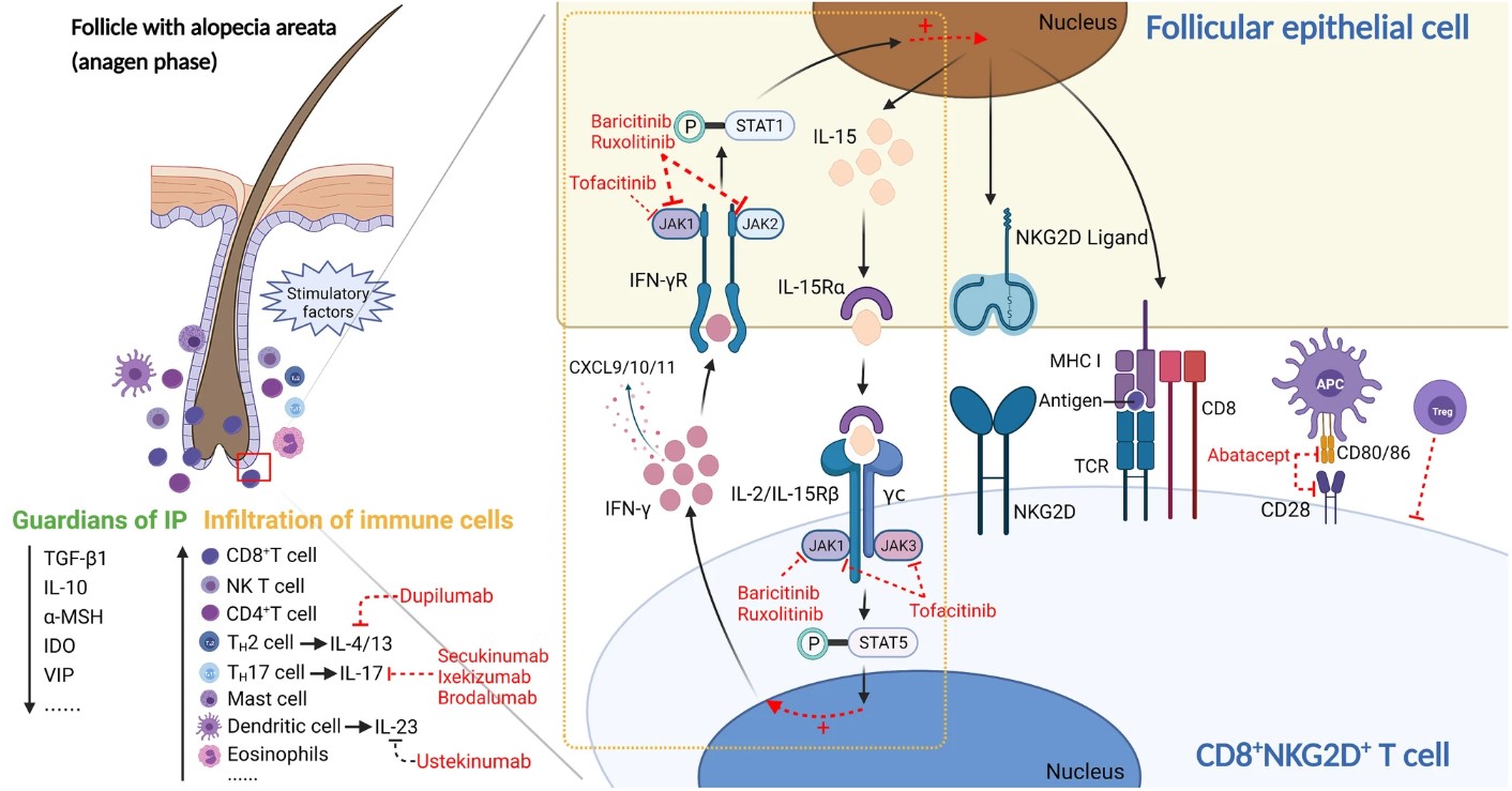 Fig. 1: Illustration of the immunopathogenesis process in alopecia areata, showcasing key factors and pathways involved.