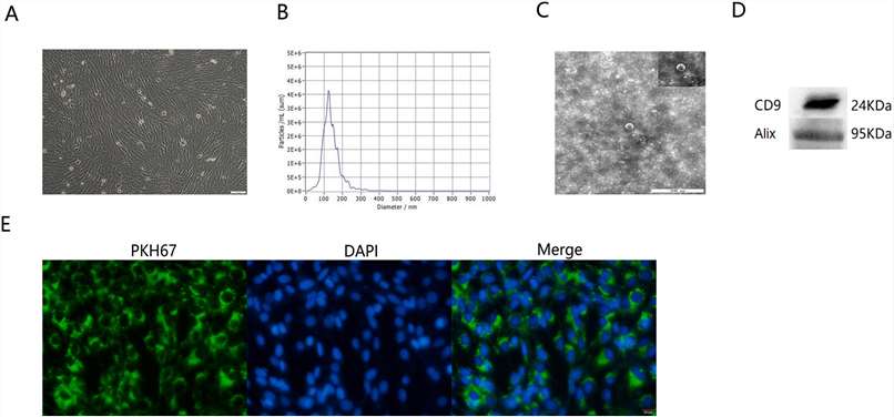 Characteristics of human hepatic progenitor cell-derived extracellular vesicles.