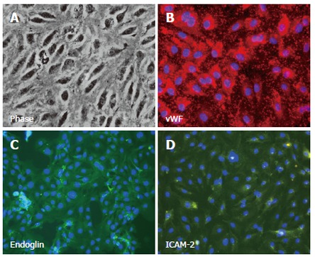 Morphology of cultured Human hepatic sinusoidal endothelial cells.