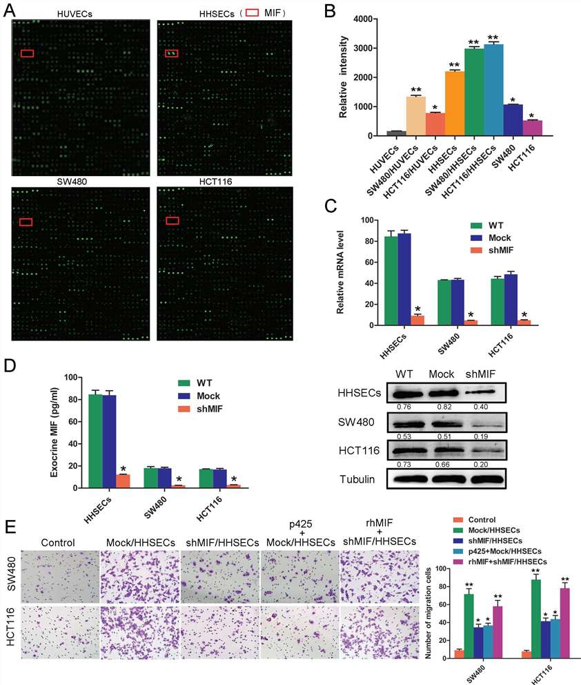 Analysis of MIF expression and function in cell migration and chemotaxis in CRC cells.