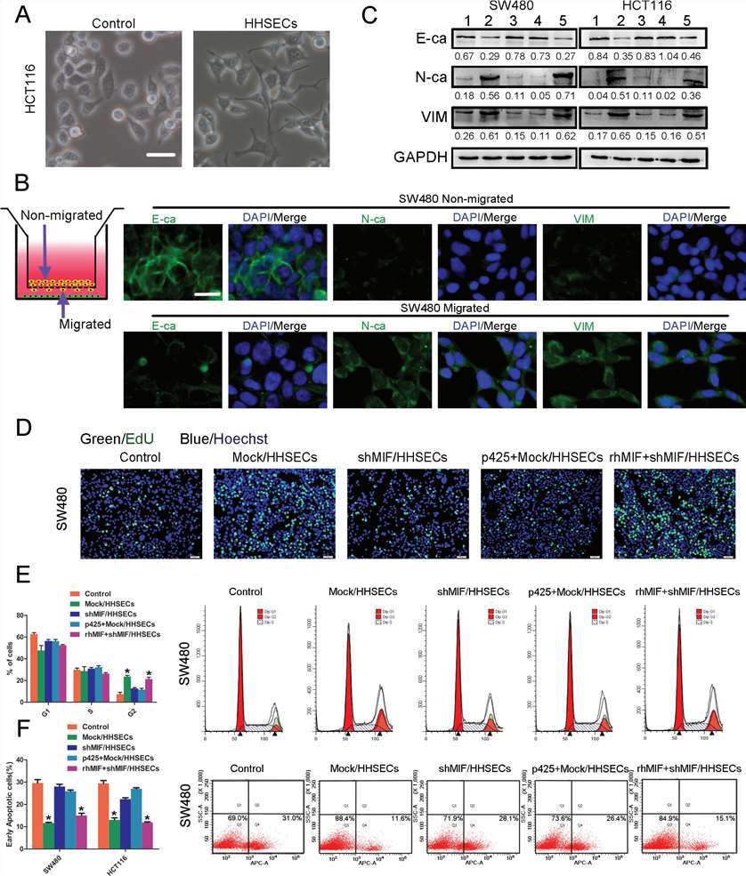 Effects of MIF on migration, proliferation, and apoptosis of colorectal cancer cells modulated by conditioned media from HHSECs.