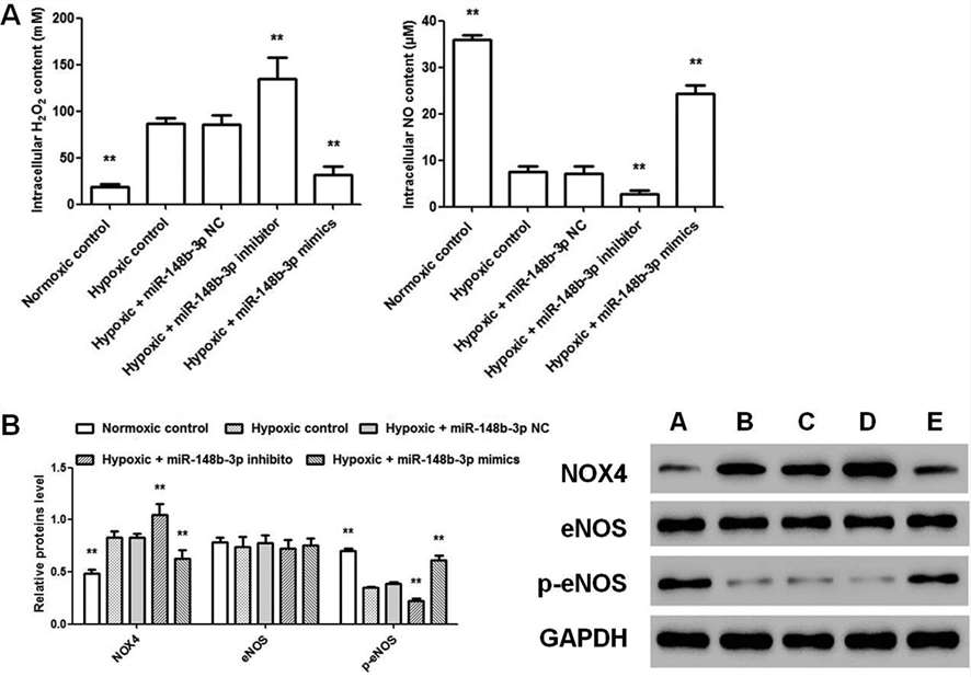 The influence of simultaneous NOX4 overexpression, lnc H19 shRNA, and modulation of miR-148b-3p on HHSECs under hypoxic conditions.