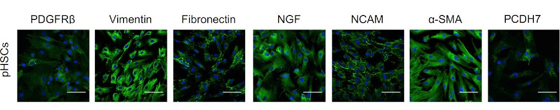 Representative immunofluorescence confocal images of human primary HSCs.