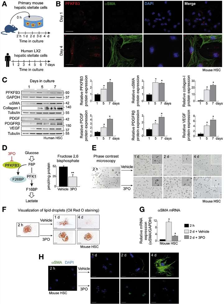 The expression of PFKFB3 protein increases during the trans-differentiation of HSCs, and inhibiting PFKFB3 reduces glycolysis in HSCs.