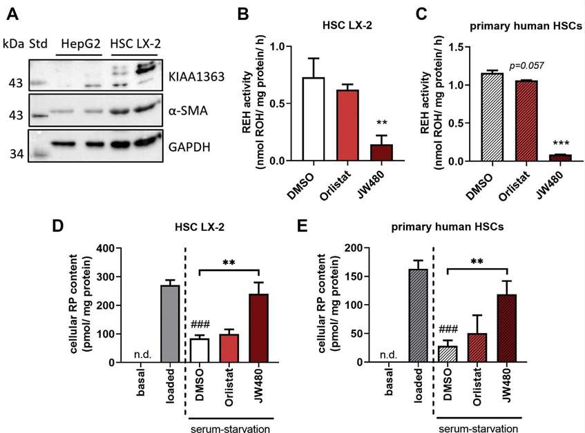 Blocking hKIAA1363 pharmacologically hinders RE degradation in LX-2 cells and primary human HSCs under serum starvation conditions.