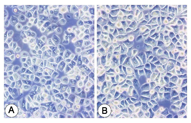 (A) Perfusion and standard isolation of primary hepatocytes resulted in healthy and viable cells. (B) Additional density gradient purification resulted in highly purified hepatocyte cultures.