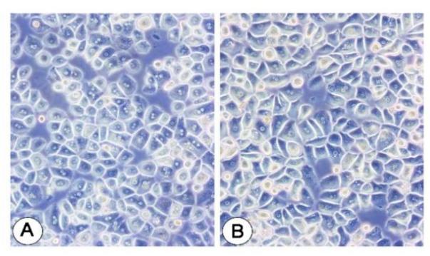 Primary human hepatocyte.