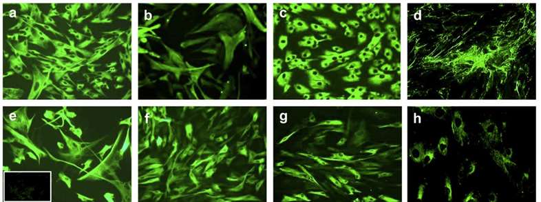 Morphological characteristics and immunophenotypic profile of liver fibroblasts cultured from adult human liver tissue.