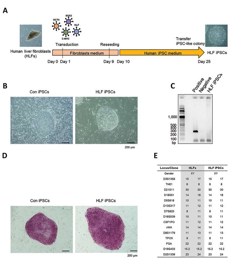 Generation of human liver fibroblasts iPSCs.