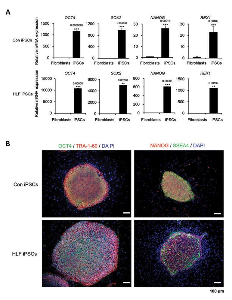 Pluripotency markers in cHCC-CC-derived human liver fibroblasts iPSCs.