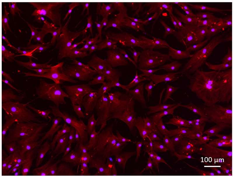 human-skeletal-muscle-myoblasts-1
