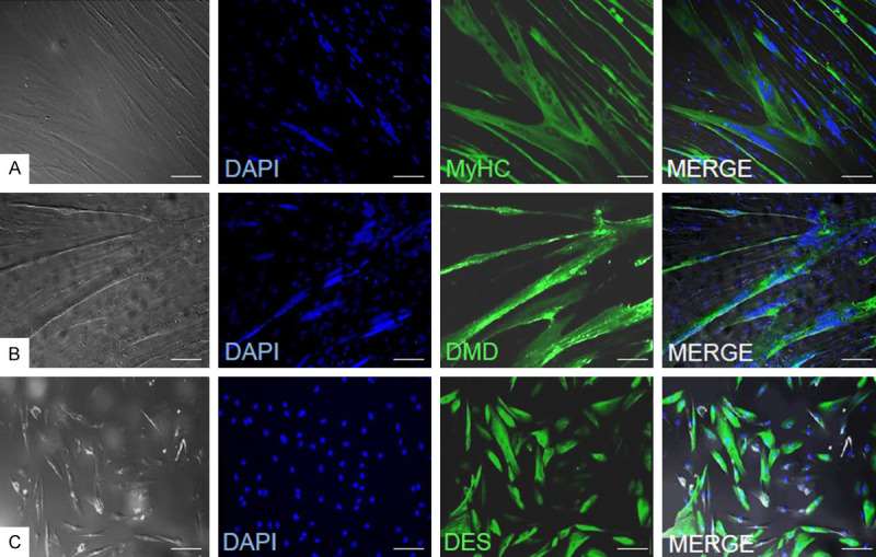 Immunofluorescence assessment of myogenic markers expression in myoblasts cultured in DMEM+FBS+FGF medium (A) and myocytes (B, C).