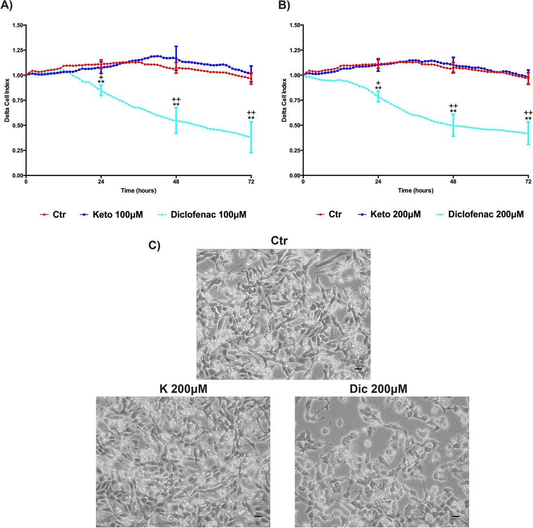 Delta Cell index (DCI) evaluation, K versus Dic, in immortalized human cardiomyocytes upon different treatment conditions. 