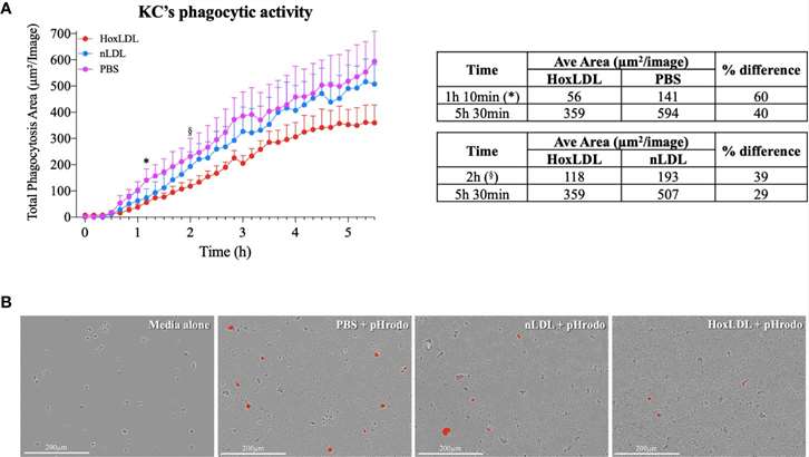 HoxLDL reduces the phagocytic activity of human Kupffer cells.