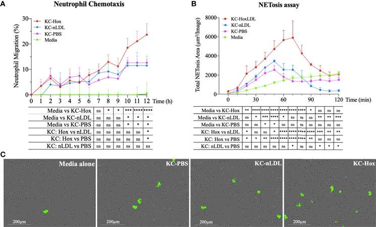 Polarization to M4 phenotype induced by HoxLDL boosts neutrophil recruitment and NETosis.