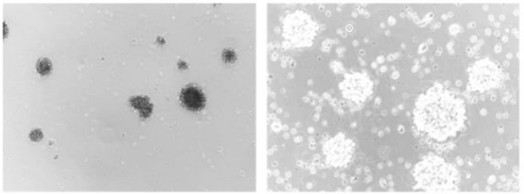 Figure 1. Human T cell immortalization by Epigenetic Induction of Cell Growth. Growing T cells at Day 2 after stimulation. NOTE: Non-fused control T cells can be cultured in the same conditions for 2 weeks before showing deteriorating cell growth.