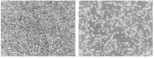 Figure 2. Human T cell immortalization by Epigenetic Induction of Cell Growth. Growing T cells at Week 3 after stimulation.