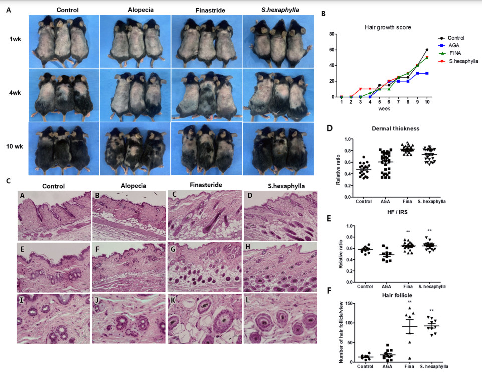 Fig. 1: Analysis of Stauntonia hexaphylla extract effects on TP-induced AGA in mice, showing skin color, hair growth, follicle morphology, and dermal thickness.