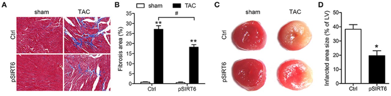 SIRT6 overexpression reduces infarct size and cardiac fibrosis post-TAC: histological and quantitative analysis.