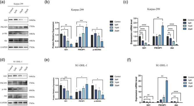 The Gli inhibitor GANT61 disrupted the PI3K/Akt signaling pathway in ALK + ALCL cell lines.