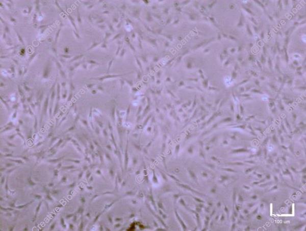 Immortalized Human Astrocytes-SV40T