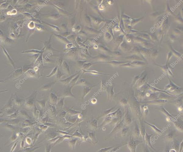 Immortalized Human Thymic Epithelial Cells