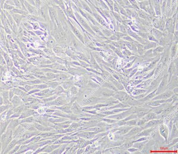 Immortalized Human Vestibular Schwannoma Cells