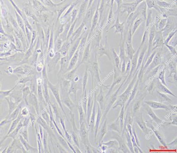 Immortalized Human Vestibular Schwannoma Cells