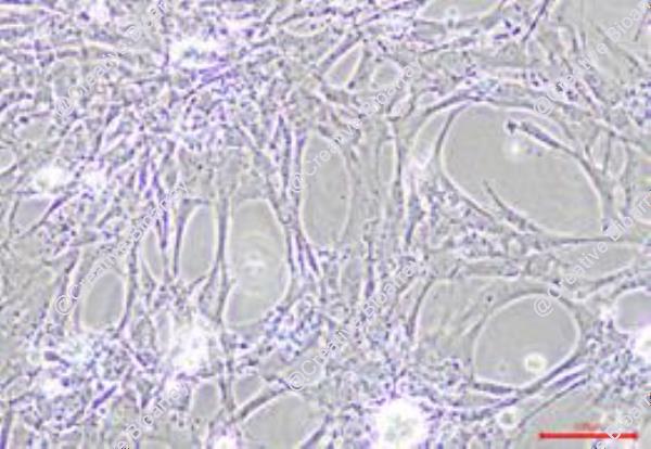 Immortalized Mouse Corneal Epithelial Cells