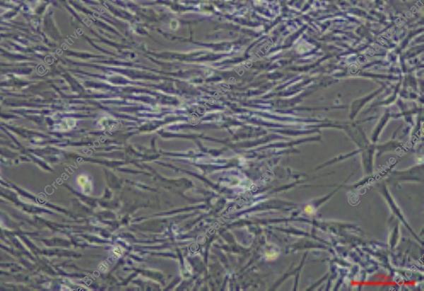 Immortalized Human Endometrial Epithelial Cells-SV40