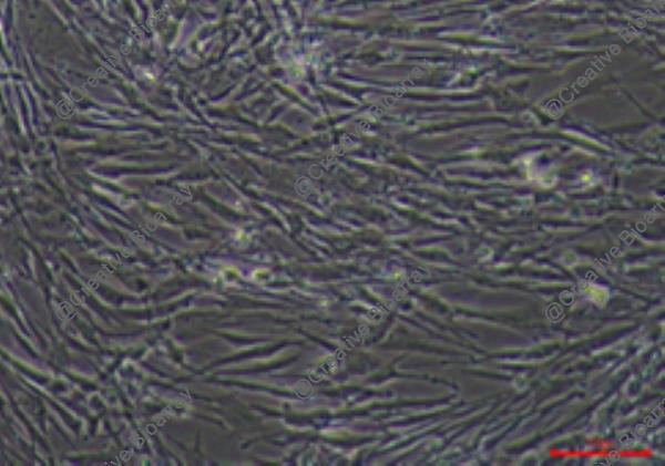 Immortalized Human Endometrial Epithelial Cells-SV40