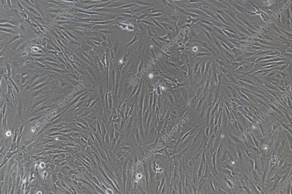 Immortalized Human Schwann Cells-SV40T