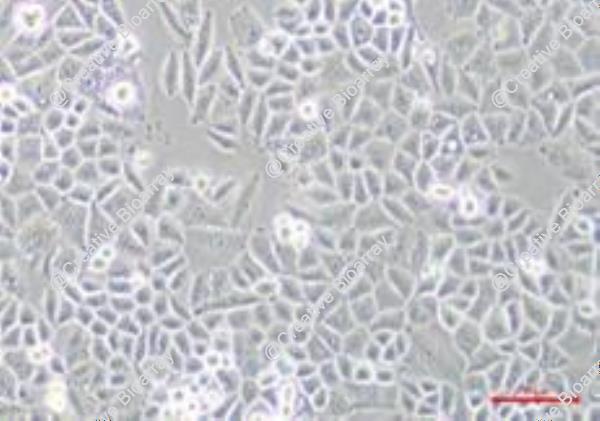 Immortalized Human Ovarian Epithelial Cells-SV40