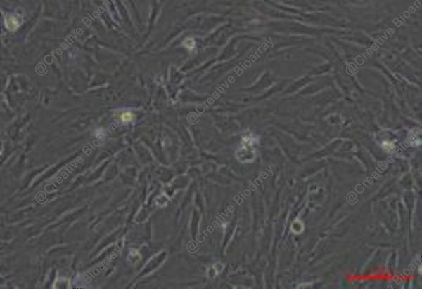 Immortalized Human Skin Fibroblast-SV40