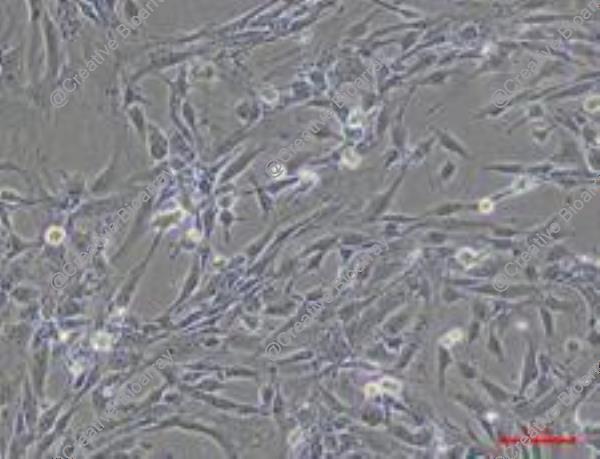 Immortalized Human Sertoli Cells-SV40