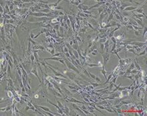 Immortalized Human Sertoli Cells-SV40